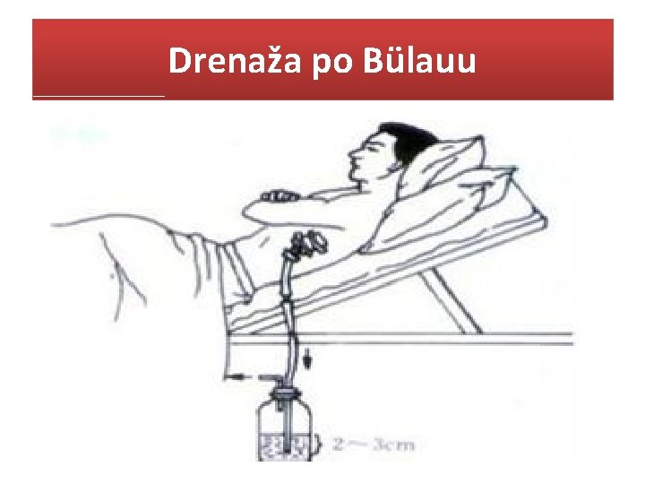 Drenaža po Bülauu 