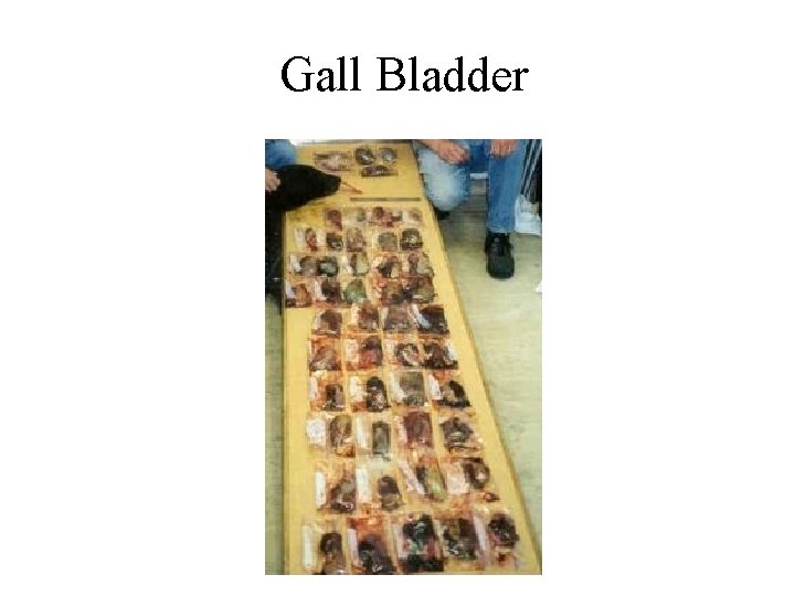 Gall Bladder 