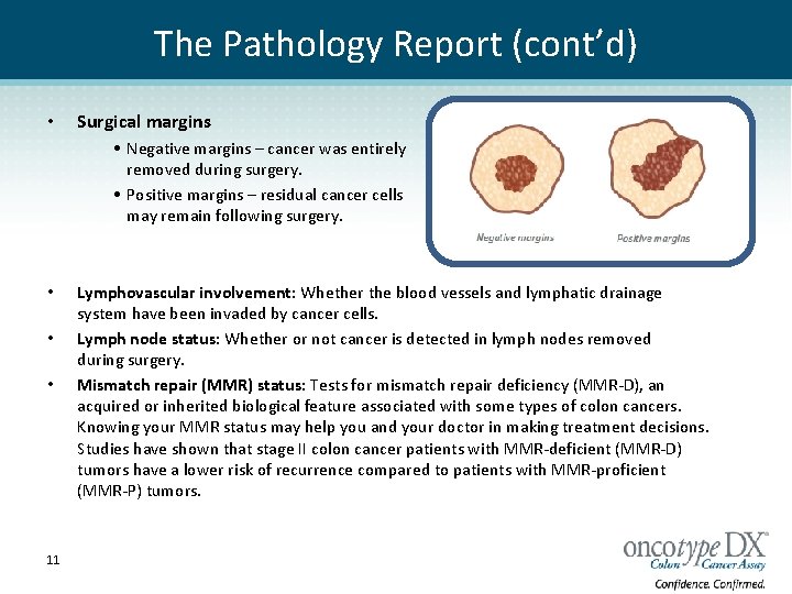 The Pathology Report (cont’d) • Surgical margins • Negative margins – cancer was entirely