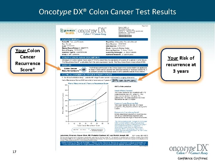 Oncotype DX® Colon Cancer Test Results Your Colon Cancer Recurrence Score® 17 Your Risk