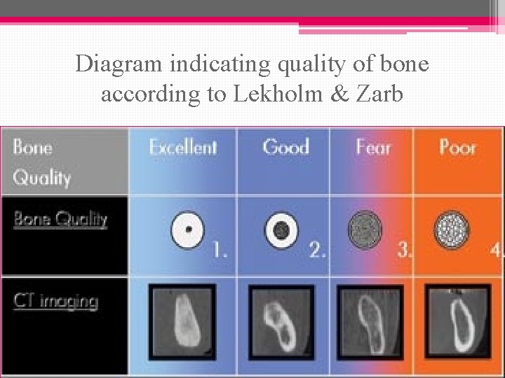 Diagram indicating quality of bone according to Lekholm & Zarb 
