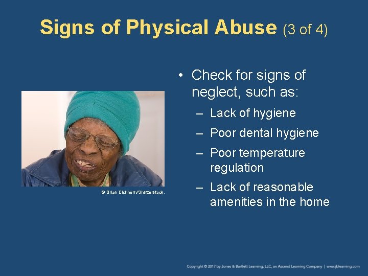 Signs of Physical Abuse (3 of 4) • Check for signs of neglect, such