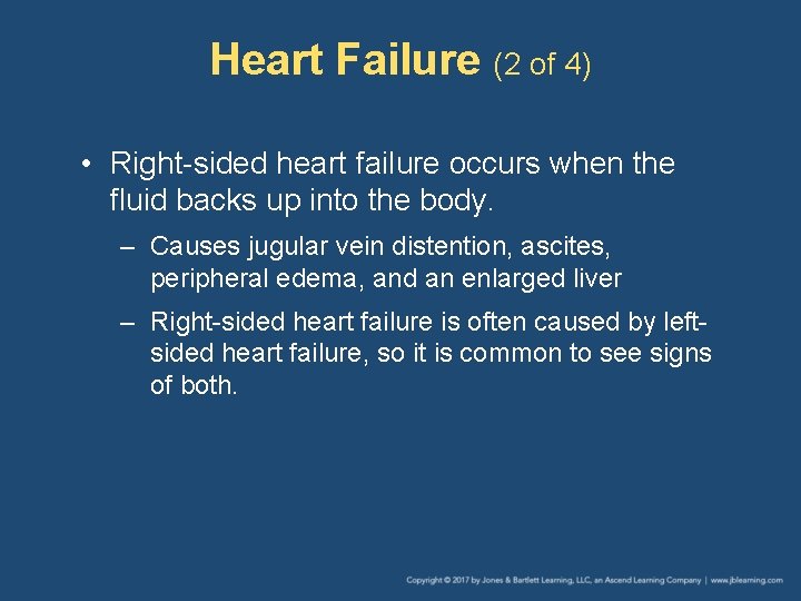 Heart Failure (2 of 4) • Right-sided heart failure occurs when the fluid backs