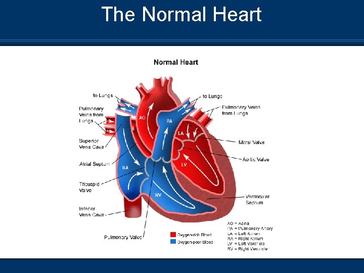 The Normal Heart 