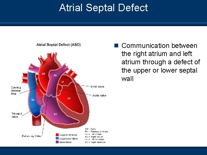 Atrial Septal Defect n Communication between the right atrium and left atrium through a