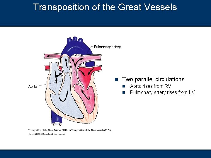 Transposition of the Great Vessels n Two parallel circulations n n Aorta rises from