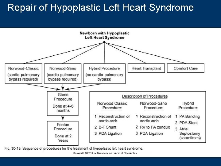 Repair of Hypoplastic Left Heart Syndrome 