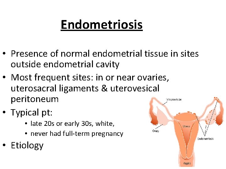 Endometriosis • Presence of normal endometrial tissue in sites outside endometrial cavity • Most