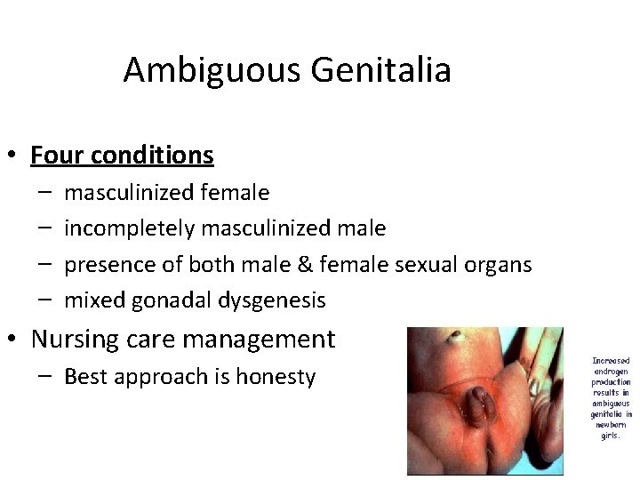 Ambiguous Genitalia • Four conditions – – masculinized female incompletely masculinized male presence of