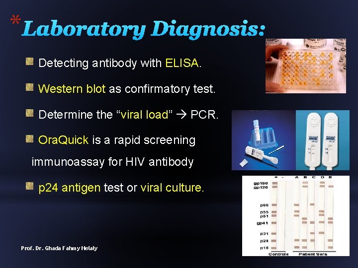 * Laboratory Diagnosis: Detecting antibody with ELISA. Western blot as confirmatory test. Determine the