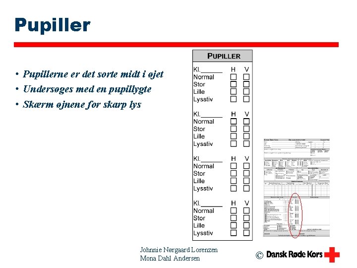 Pupiller • Pupillerne er det sorte midt i øjet • Undersøges med en pupillygte