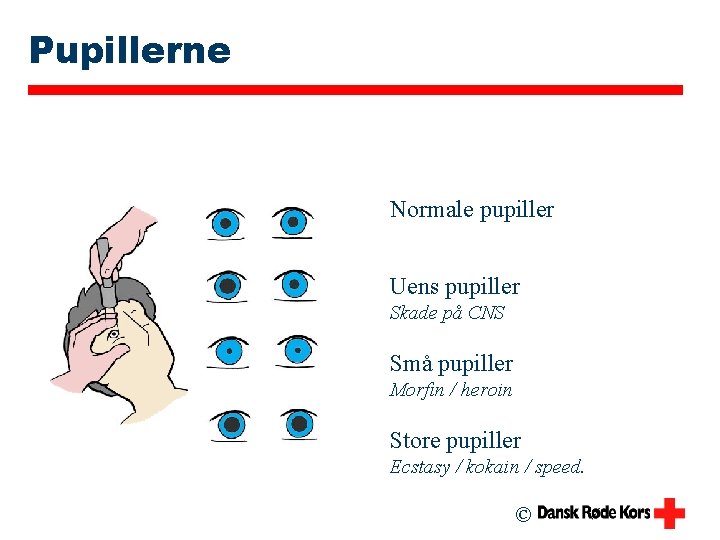 Pupillerne Normale pupiller Uens pupiller Skade på CNS Små pupiller Morfin / heroin Store