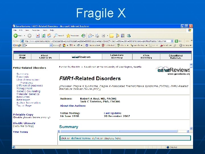 Fragile X 