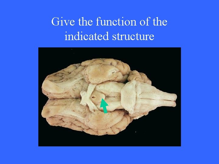 Give the function of the indicated structure 