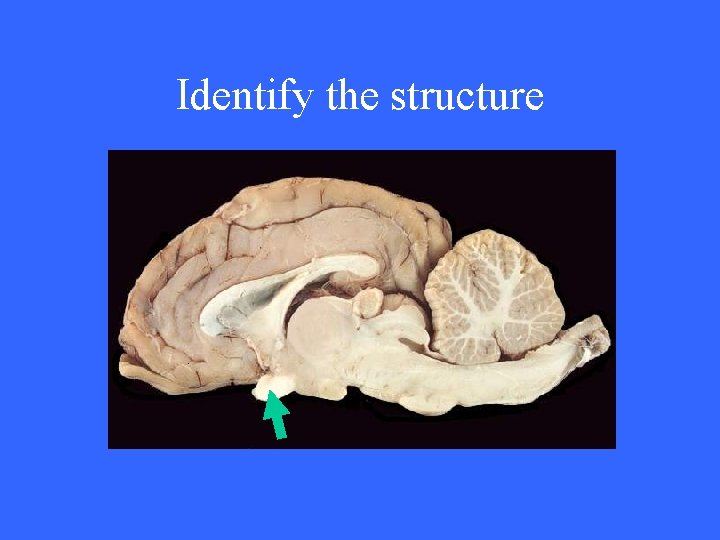 Identify the structure 