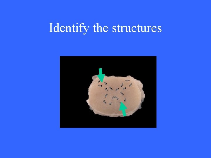 Identify the structures 