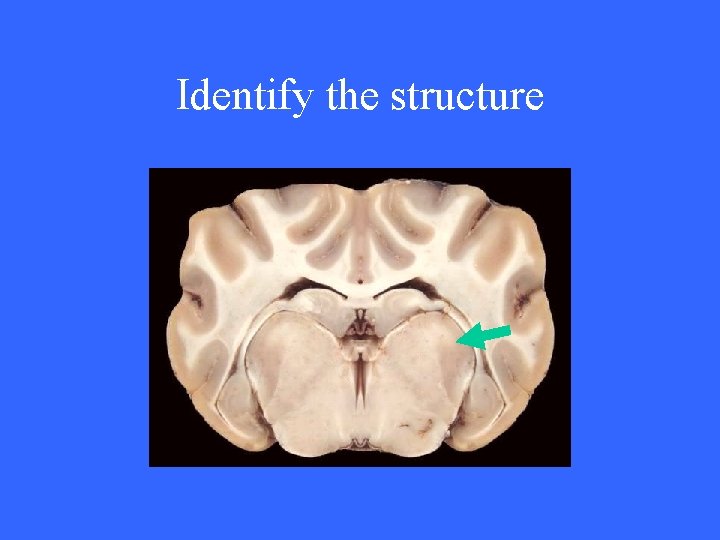 Identify the structure 