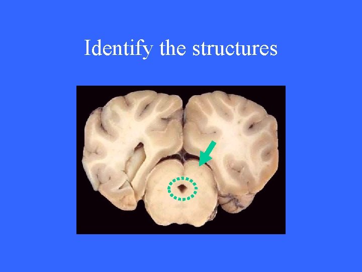 Identify the structures 