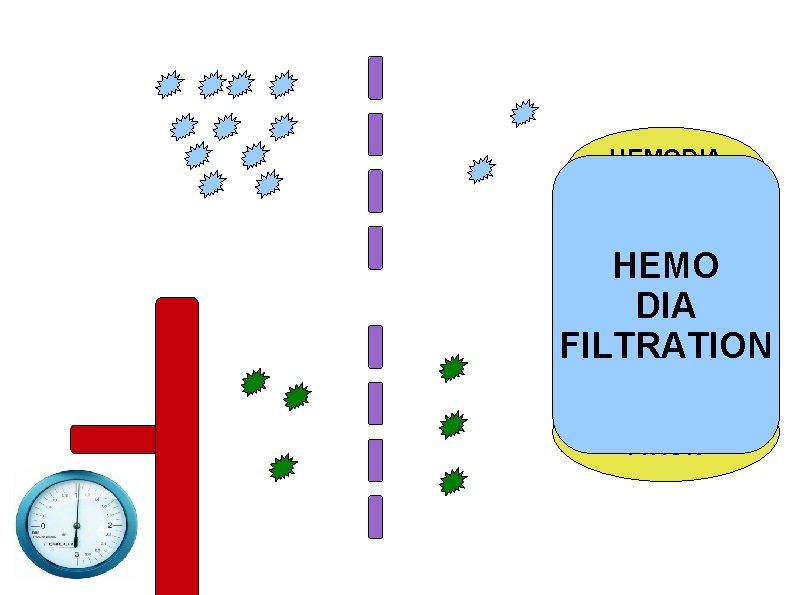 HEMODIA DIFFUSIO LYSE N HEMO DIA FILTRATION HEMOFILTR CONVECTI ATION ON 