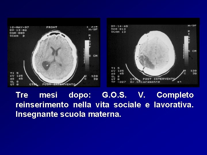 Tre mesi dopo: G. O. S. V. Completo reinserimento nella vita sociale e lavorativa.