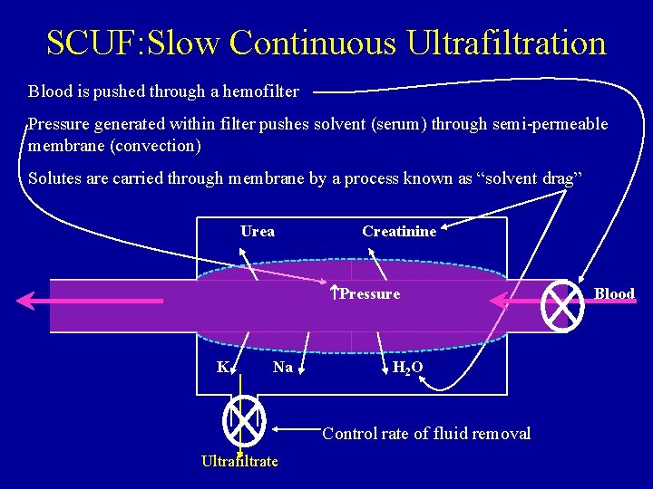 SCUF: Slow Continuous Ultrafiltration Blood is pushed through a hemofilter Pressure generated within filter