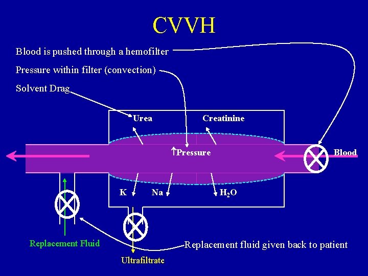 CVVH Blood is pushed through a hemofilter Pressure within filter (convection) Solvent Drag Urea