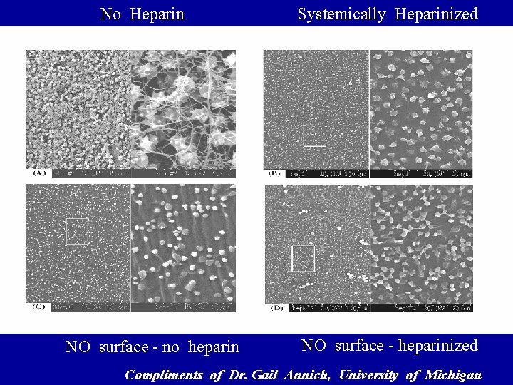 No Heparin NO surface - no heparin Systemically Heparinized NO surface - heparinized Compliments