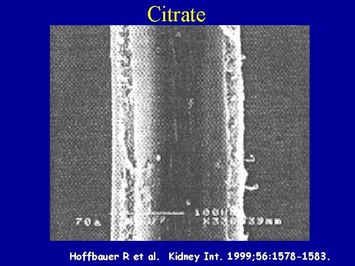 Citrate Hoffbauer R et al. Kidney Int. 1999; 56: 1578 -1583. 