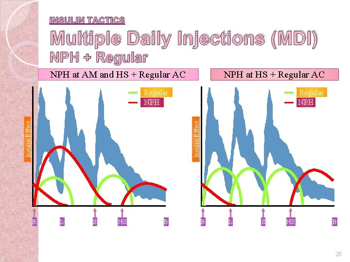 INSULIN TACTICS Multiple Daily Injections (MDI) NPH + Regular NPH at AM and HS