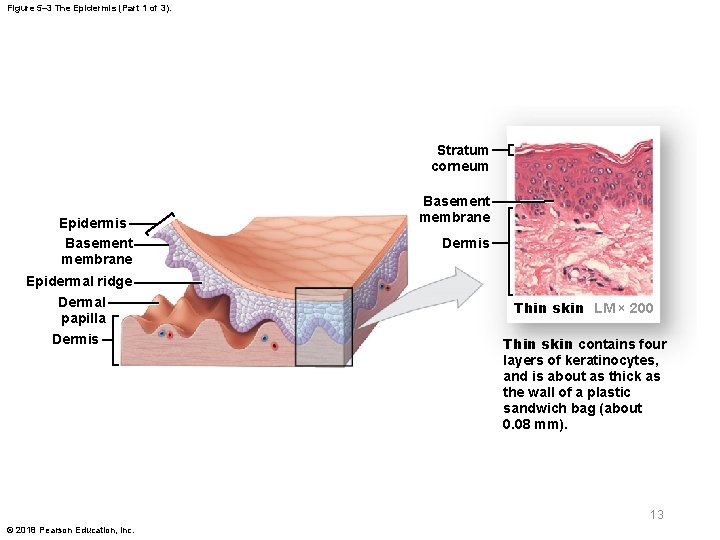 Figure 5– 3 The Epidermis (Part 1 of 3). Stratum corneum Epidermis Basement membrane