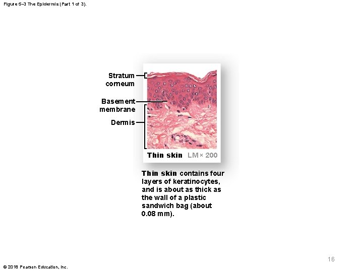 Figure 5– 3 The Epidermis (Part 1 of 3). Stratum corneum Basement membrane Dermis