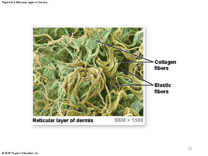 Figure 5– 4 Reticular Layer of Dermis. Collagen fibers Elastic fibers Reticular layer of