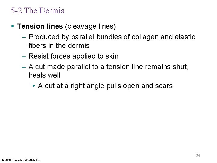 5 -2 The Dermis § Tension lines (cleavage lines) – Produced by parallel bundles