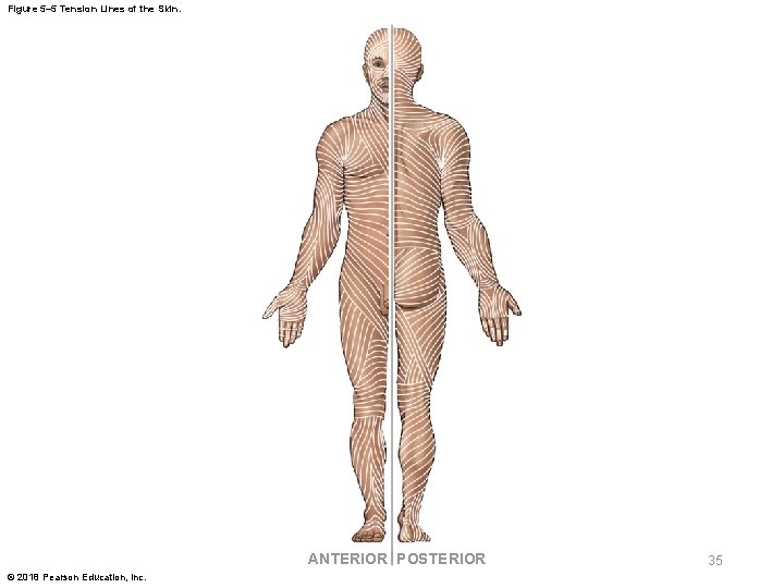 Figure 5– 5 Tension Lines of the Skin. ANTERIOR POSTERIOR © 2018 Pearson Education,