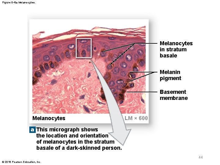 Figure 5– 8 a Melanocytes in stratum basale Melanin pigment Basement membrane Melanocytes LM