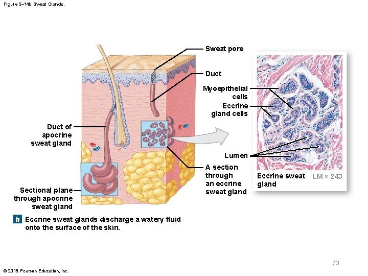 Figure 5– 14 b Sweat Glands. Sweat pore Duct Myoepithelial cells Eccrine gland cells