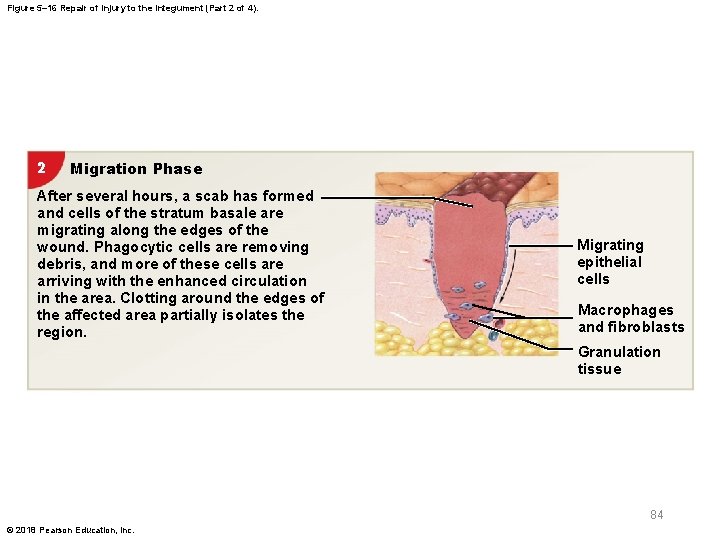 Figure 5– 16 Repair of Injury to the Integument (Part 2 of 4). 2