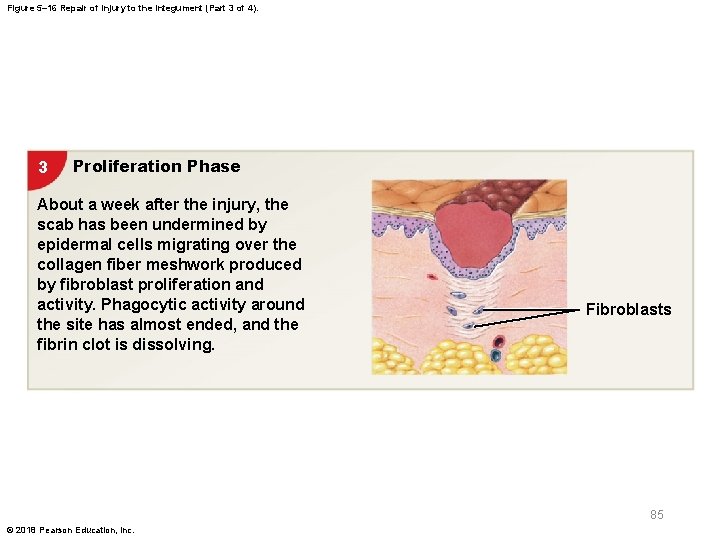 Figure 5– 16 Repair of Injury to the Integument (Part 3 of 4). 3