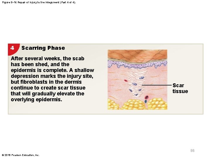 Figure 5– 16 Repair of Injury to the Integument (Part 4 of 4). 4