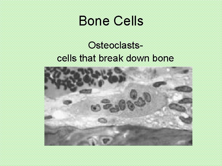 Bone Cells Osteoclastscells that break down bone 