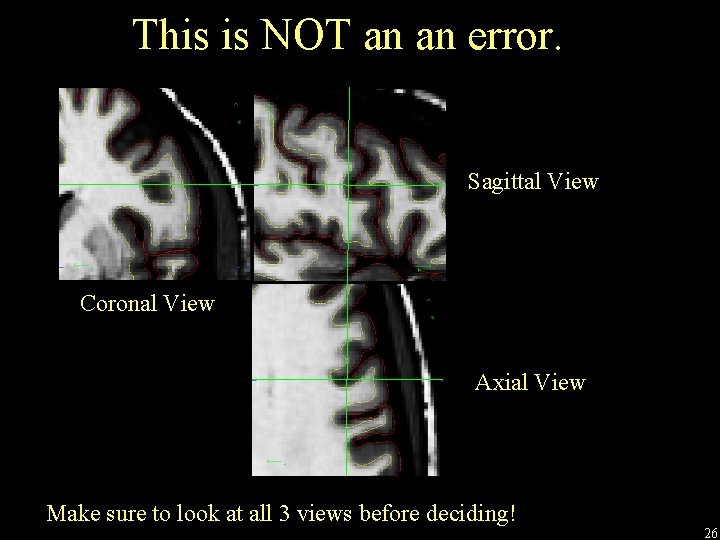 This is NOT an an error. Sagittal View Coronal View Axial View Make sure