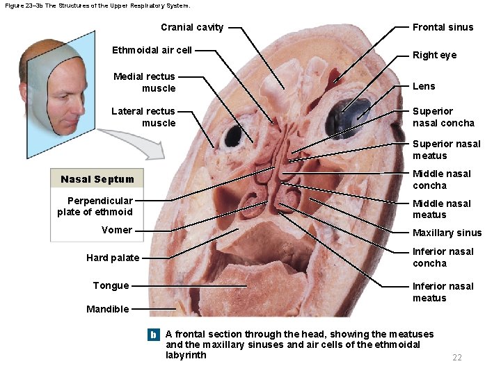 Figure 23– 3 b The Structures of the Upper Respiratory System. Cranial cavity Ethmoidal