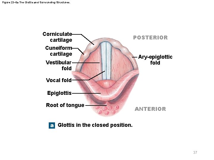 Figure 23– 5 a The Glottis and Surrounding Structures. Corniculate cartilage Cuneiform cartilage Vestibular