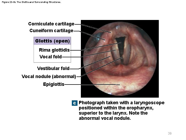 Figure 23– 5 c The Glottis and Surrounding Structures. Corniculate cartilage Cuneiform cartilage Glottis