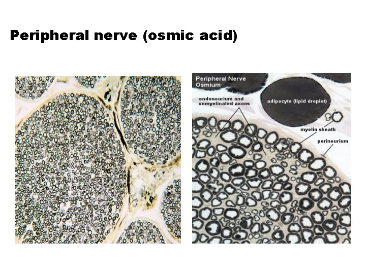 Peripheral nerve (osmic acid) 