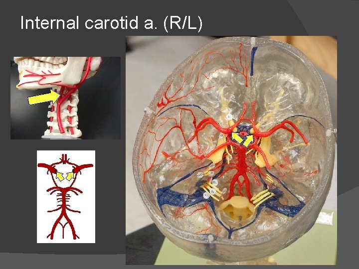 Internal carotid a. (R/L) 