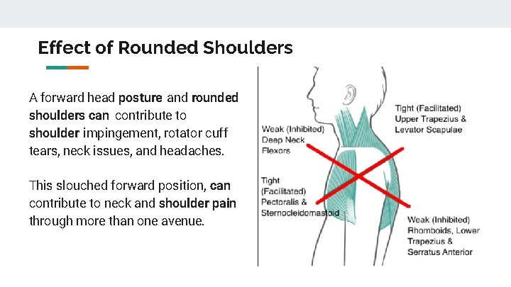 Effect of Rounded Shoulders A forward head posture and rounded shoulders can contribute to