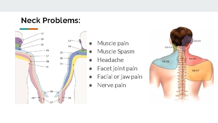 Neck Problems: ● ● ● Muscle pain Muscle Spasm Headache Facet joint pain Facial