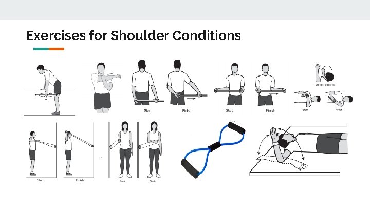 Exercises for Shoulder Conditions 