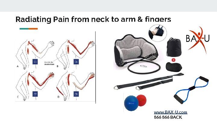 Radiating Pain from neck to arm & fingers www. BAX-U. com 866 BACK 